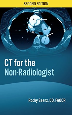 Full Download CT for the Non-Radiologist: The Essential CT Study Guide - Rocky Saenz | PDF